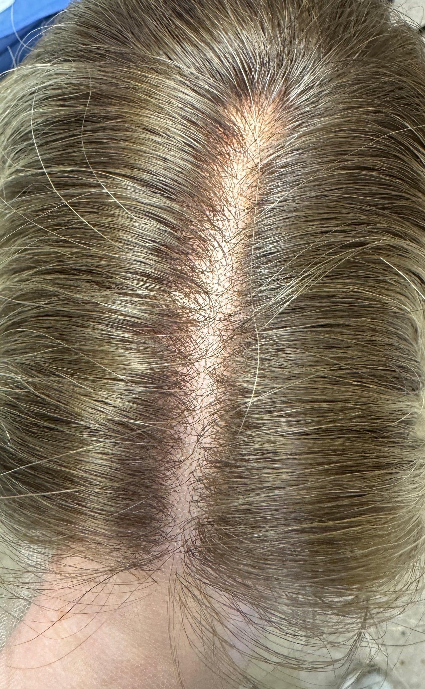**FINAL SALE** #420 Highest Quality Remy Human Hair Lace Top Wig (S/XS)14/15”